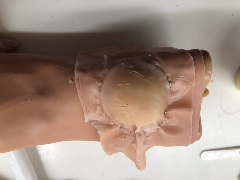 IV training arm with trainer skin stapled over a simulated abscess