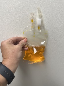 A hand holds a clear fluid bag with yellow liquid inside, featuring attached tubing and ports, against a white wall.