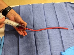 A person’s hand holds a syringe filled with dark red liquid attached to a long red tube, positioned on a blue medical pad with a blue glove visible in the corner.