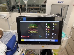 Tablet displaying patient monitor data mounted in front of ePM12 monitor, connected via wireless HDMI transmitter