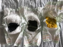 Three newborn diapers. One diaper with black substance. One diaper with dark green substance. One diaper with chunky yellow substance.