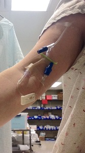 close-up of standardized participant's upper arm with IV tubing attached