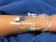 simulated two part IV system taped to a forearm