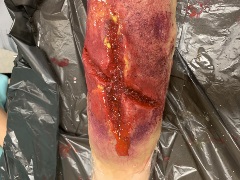A simulated traumatic leg wound with deep lacerations, bruising, and signs of infection or tissue damage, placed on a black plastic-covered surface