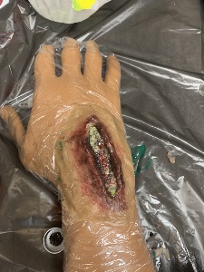 A simulated deep wound on a manikin hand covered in plastic wrap, featuring realistic tissue damage, discoloration, and infection details