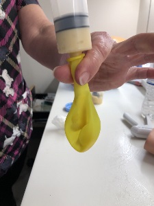 woman using a tomey syringe to fill a yellow balloon with tapioca pudding