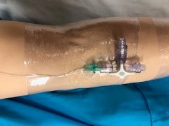 manikin arm with shrink wrap tube adhered to antecubital fossa and external IV circuit affixed