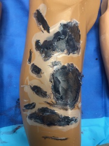 Manikin arm covered with dried white liquid school glue with parts of the dried glue chipped off. Black stage makeup applied where glue was chipped off and to the flaps of glue peeled back.