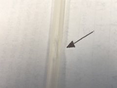 black arrow pointing to a hole in the IV tubing