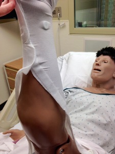 manikin wearing a compression sock on his calf that had been cut and reattached with hook and loop fasteners