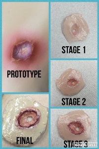 Collage of 5 photos. Prototype shows real venous ulcer, stage 1 shows light pink indentation, stage 2 shows medium pink indentation, stage 3 shows deeper pink indentation with red ridge, and final shows darker pink indentation with a dark red ridge.
