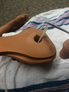 hemostat grabbing tubing and pulling it out through the manikin colostomy hole